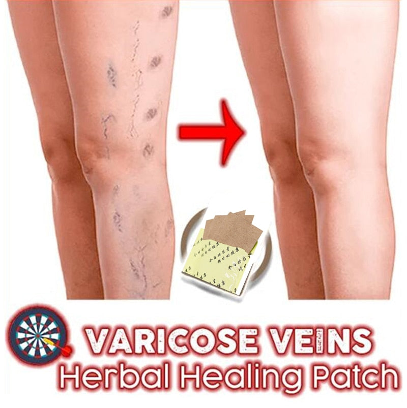 6 Patches Spider Veins Varicose Treatment Plaster Varicose Veins Cure Patch Vasculitis Natural Solution Herbal Patche